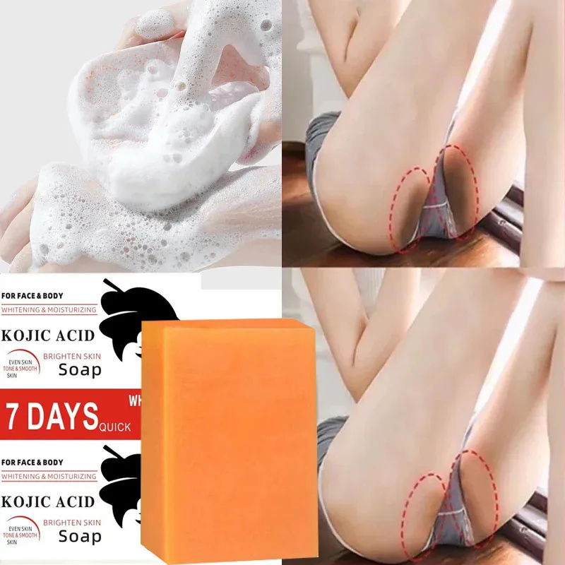 Kojic Acid Soap - Kojic Acid Body Whitening Soap Deep