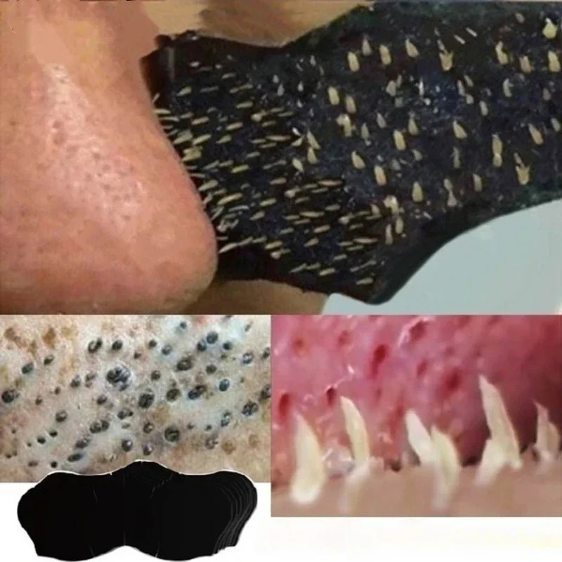 Unisex Blackhead Remove Mask N - Skincare Viral Tiktok 评论和价格