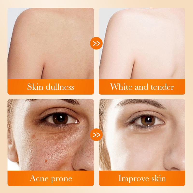 1Pc SADOER Kojic Acid Facial S - Kojic Acid Soap 评论和价格